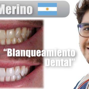 Curso blanqueamiento dentario dictado por el doctor merino ariel de manera online